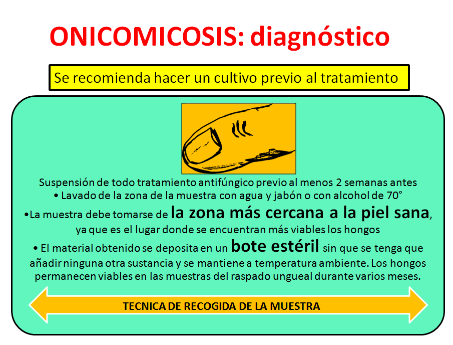 onicomicosis-1